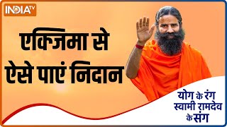 Yoga TIPS | क्या आप Eczema से हैं परेशान? Swami Ramdev से जानिए क्या है निदान