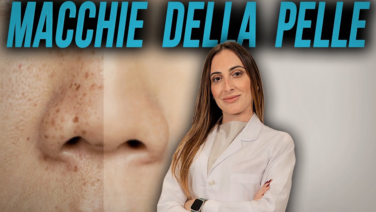 RIMUOVERE LE MACCHIE DELLA PELLE CON LASER E LUCE PULSATA