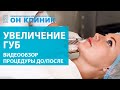 Увеличение губ, результат до/после в ОН КЛИНИК 2020