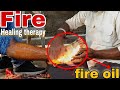 Fire Healing therapy to relief hard pain by Painkiller baba (jamshed bhai) - ASMR leg massage