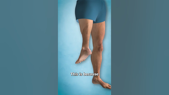 The Surgery That Turns Legs Around 🔄🦵