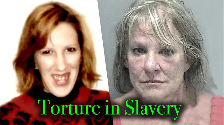 NURSE BRINGS PATIENT HOME AS SLAVE, the Horrifying...