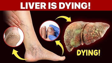 WARNING! 12 Early Signs of Liver Failure You Should NEVER IGNORE! | liver disease symptoms