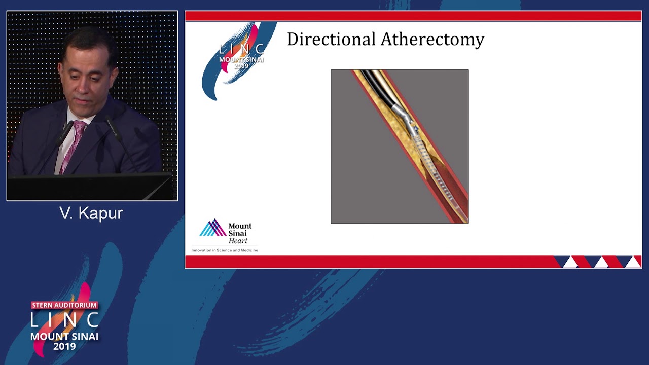 Stern D2 - Choice of Atherectomy - Device Related Tips and Tricks - Dr. Vishal Kapur