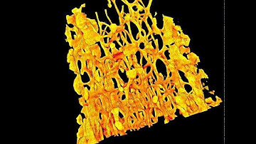 3-D Visualization of Trabecular Bone in a Mouse Femur