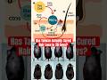 Taiwan 20 Day Hair Loss Cure - Media Hype or Hair Loss Hack Evolving? #hair #hairlosstreatment