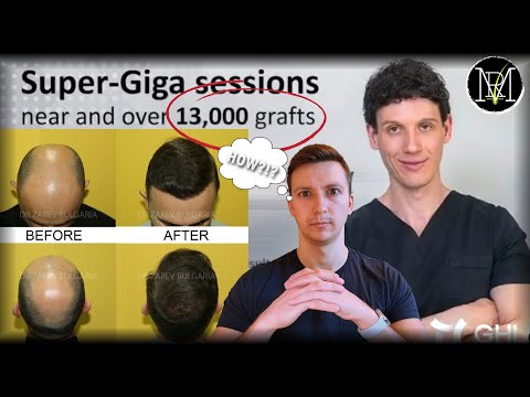 1/6 Joe ヘッド with Hair Implantation 1/6 Joe ヘッド with Hair Implantation 1/6 Joe ヘッド with