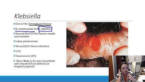Come prendere Klebsiella?