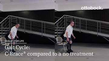 Gait Cycle: C-Brace® compared to a no treatment | Ottobock