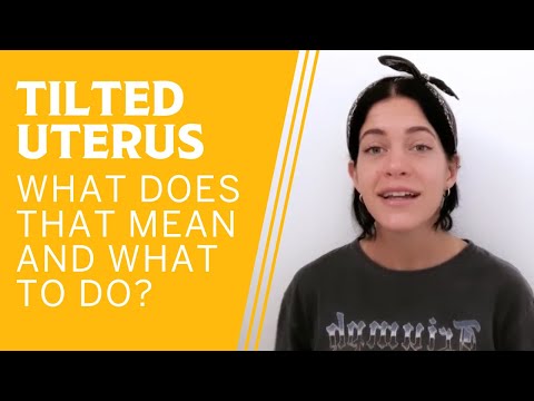 What is a Tilted Uterus?