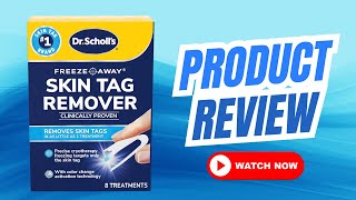 Honest Review of This Skin Tag Remover Kit!
