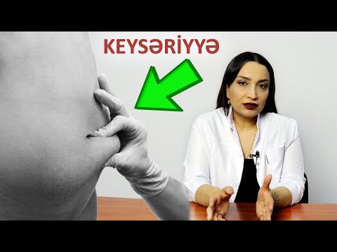 Video: Mühərrikdə çirklənmənin səbəbi nədir?