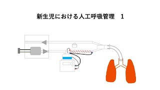 新生児における人工呼吸管理1