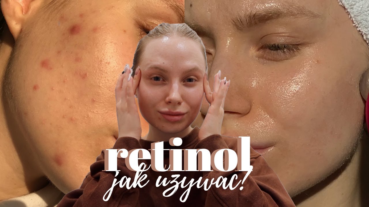 STOSUJĘ RETINOL OD ROKU - jak zacząć? o czym trzeba wiedzieć? jak sobie nie zrobić krzywdy?