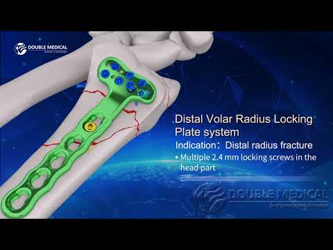 Double Medical Distal Volar Radius Locking Plate