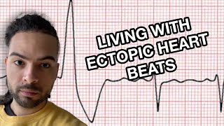 5 Tips for Living with Anxiety and Ectopic Heart Beats