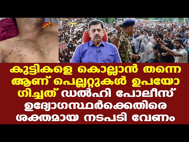 CJP | Rahul | ഡല്‍ഹി പോലീസ് ഉദ്യോഗസ്ഥര്‍ക്കെതിരെ അതിശക്ത നടപടി എടുക്കേണ്ടി വരും