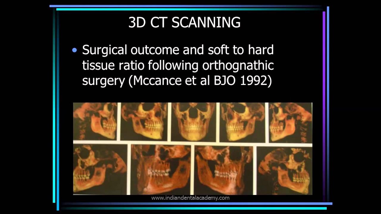 recent advances in diagnostic aids / orthodontic courses by Indian