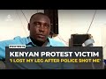 Kenya protest survivor lost his leg and his hope for change