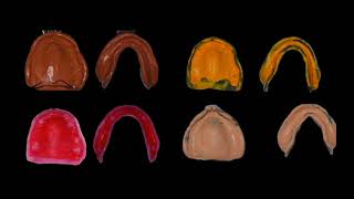 Complete dentures.. Traditional to modern..Webinar with Indian dental Association, September 2020