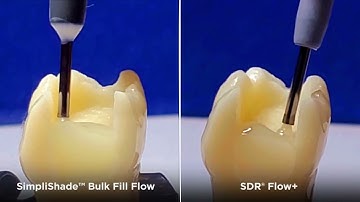 See the Difference: SimpliShade™ Bulk Fill Flow vs. SDR® flow+