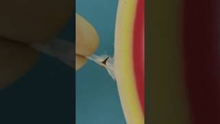 Splinter Hacks #goodtoknow #splinterremoval #lifehacks #vet #medicine #surgery #doctor #surgeon