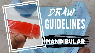 Guide lines for the mandibular cast | CHEAT LINES