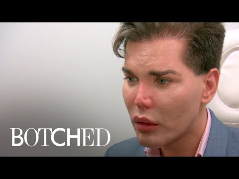Dr. Paul Nassif Says Patient's Nose "Could Fall Off" | Botched | E!