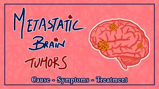 Brain Metastases: Cause, symptoms and treatment