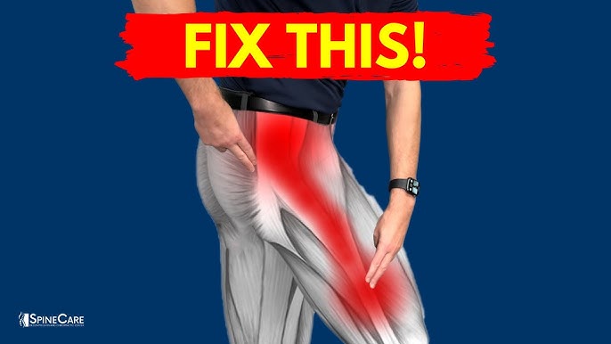 How to Relieve Iliotibial Band Pain FOR GOOD 