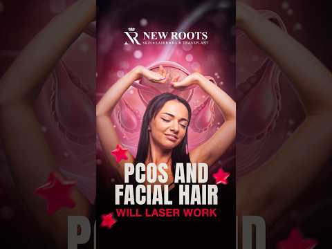 PCOS Facial Hair? Will Laser Hair Reduction Work? | Dermatologist Explains #Shorts