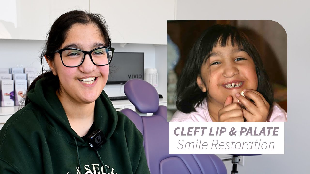 Cleft Lip & Palate Dental Bridge | Restoring Function and Confidence
