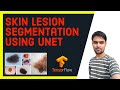 Skin Lesion Segmentation using UNET in TensorFlow 2.0 | Skin Caner Segmentation | UNET