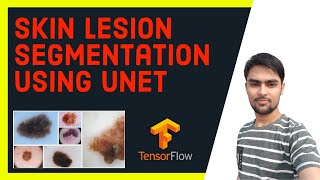 Skin Lesion Segmentation using UNET in TensorFlow 2.0 | Skin Caner Segmentation | UNET screenshot 4