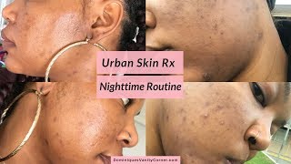 urban skin rx acne serum