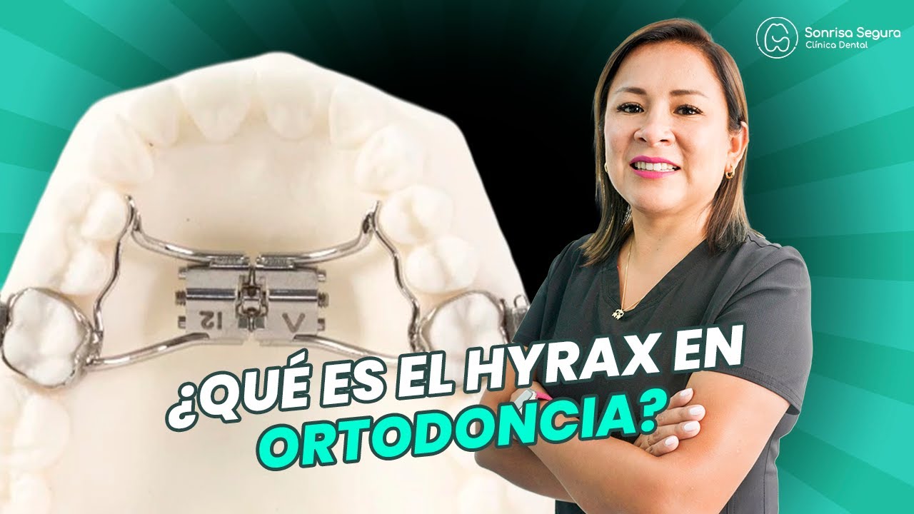 ↔️ Hyrax Dental: Creando el Espacio para una Sonrisa Perfecta 🦷