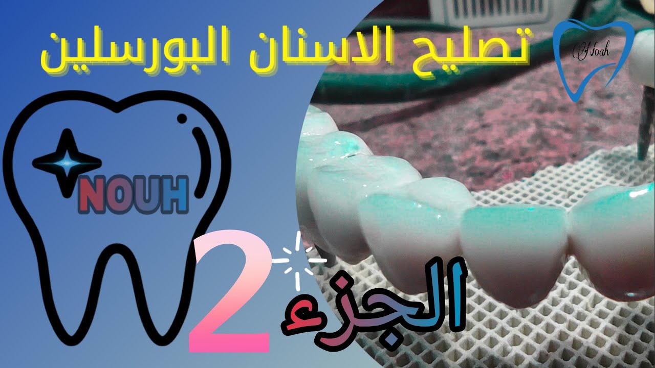 لو الاسنان البورسلين اتكسرت هتعمل ايه (الجزء الثاني) Porcelain Teeth Repair