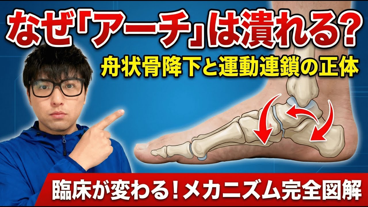 【扁平足】なぜアーチは潰れるのか？舟状骨の降下と距骨下関節の運動連鎖メカニズム