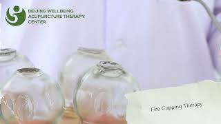 Discover Traditional Chinese Medicine (TCM)  | Beijing Well Being Acupuncture Therapy Center Dubai