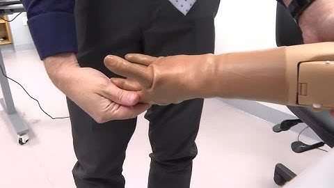 Bionic arm restores feeling of touch and movement