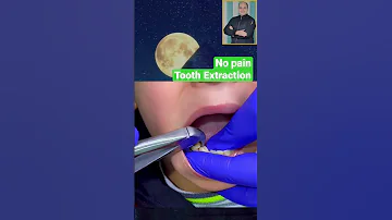 No Pain Tooth Extraction خلع الاسنان بدون ألم 