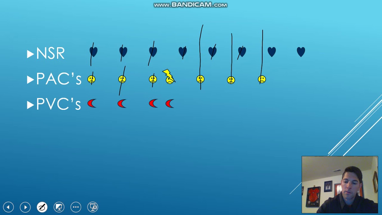Dr Rapoff ECG shorts PVC's vs PAC's - YouTube
