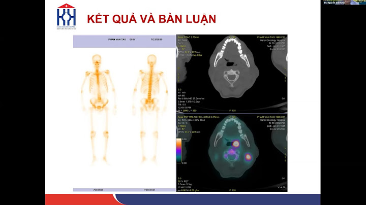 Giá trị hấp thu trung bình của fdg là gì năm 2024