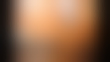 Video 3  Approach to G7 detaching the caudate process