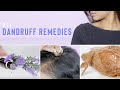 HOW TO GET RID OF DANDRUFF AT HOME | DIY DANDRUFF REMEDIES FOR THICK &amp; HEALTHY HAIR