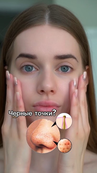 Черные точки и сальные нити. КАК ИЗБАВИТЬСЯ?🥵🥵 - YouTube