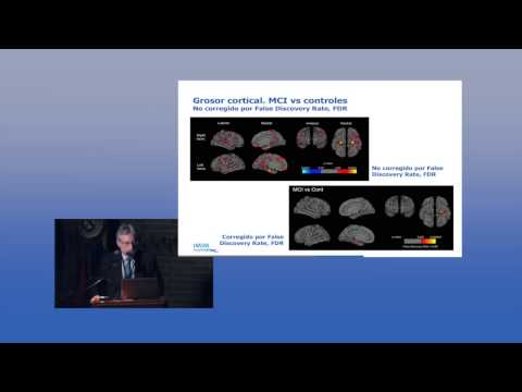 Jordi Peña:  Perfiles Neuropsicológicos en la Enfermedad de Alzheimer