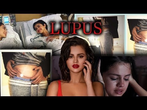 Videó: Selena Gomez Megosztja A Lupus Veseátültetési Történetét