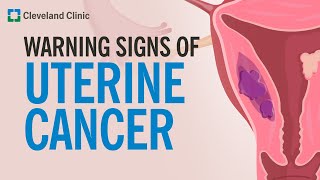 The Most Common Warning Sign of Uterine Cancer screenshot 1