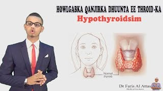 HOWLGABABKA QANJIRKA DHUUNTA EE THYROID-KA (hypothyroidism) Dr faris